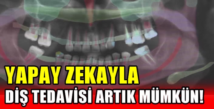 Yapay zekayla diş tedavisi artık mümkün!